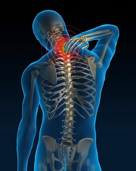 In the early stages of cervical osteochondrosis treatment, pain in the neck increases