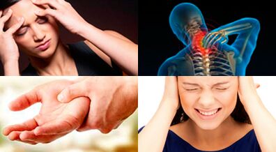 Symptoms of cervical spine osteochondrosis